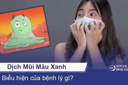 Dịch mũi màu xanh biểu hiện của bệnh lý gì?