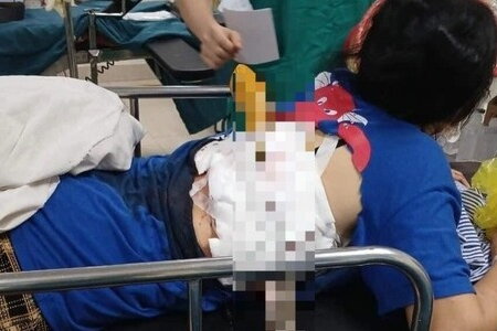 Một phụ nữ ở Hà Tĩnh bị chồng dùng dao nhọn phóng xuyên lưng