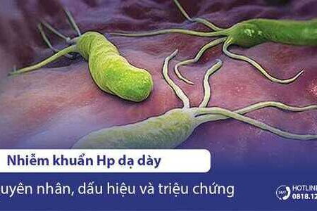 Nhiễm khuẩn HP dạ dày: Nguyên nhân, dấu hiệu và triệu chứng