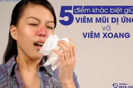 5 điểm khác biệt giữa viêm xoang và viêm mũi dị ứng