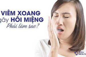 Viêm xoang gây hôi miệng phải làm sao?