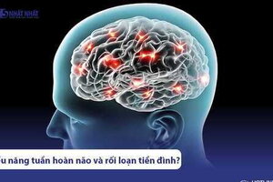 Phân biệt thiểu năng tuần hoàn não và rối loạn tiền đình