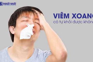 Bệnh viêm xoang có tự khỏi?