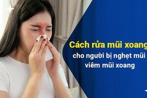 Cách rửa mũi xoang cho người bị nghẹt mũi, viêm mũi xoang