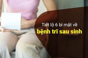 Tiết lộ 6 bí mật về bệnh trĩ sau sinh cho chị em