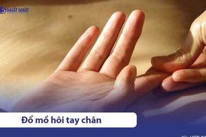 Ra mồ hôi tay chân nhiều là bệnh gì? Nguyên nhân & cách điều trị