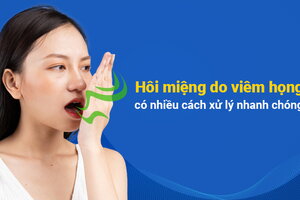 Hôi miệng do viêm họng: có nhiều cách xử lý nhanh chóng!