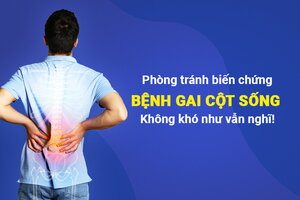 Phòng tránh biến chứng bệnh gai cột sống: Không khó như vẫn nghĩ