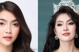 Tân Hoa hậu Đại dương Thu Uyên thừa nhận phẫu thuật thẩm mỹ 