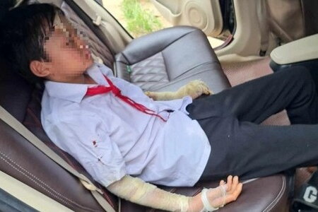 Lộ nguyên nhân vụ nổ bóng bay khiến 6 học sinh dự lễ khai giảng phải nhập viện ở Thanh Hóa