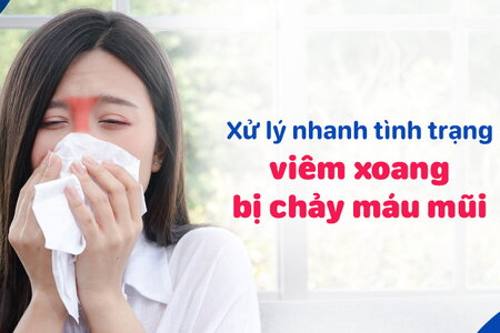 Xử lý nhanh tình trạng viêm xoang bị chảy máu mũi 