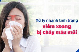 Xử lý nhanh tình trạng viêm xoang bị chảy máu mũi