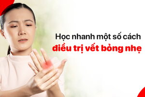 Học nhanh một số cách điều trị vết bỏng nhẹ tại nhà