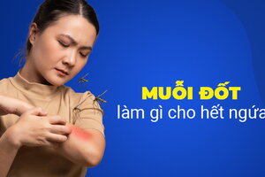 Muỗi đốt làm gì cho hết ngứa, bạn có biết không?