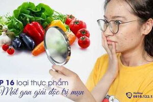 TOP 16 thực phẩm mát gan giải độc trị mụn