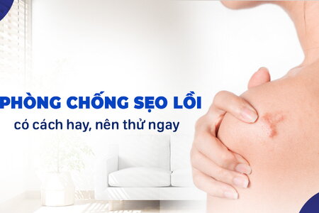 Phòng chống sẹo lồi: có cách hay, nên thử ngay!