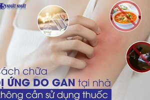 TOP những cách chữa dị ứng do gan tại nhà không cần sử dụng thuốc