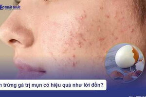 Lăn trứng gà trị mụn có hiệu quả "như lời đồn"?