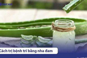 10 Cách chữa bệnh trĩ bằng nha đam hiệu quả, dễ thực hiện