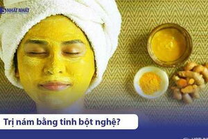 10 cách trị nám da bằng nghệ cực kỳ hiệu quả, an toàn, dễ làm