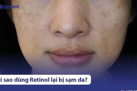 Tại sao dùng retinol bị sạm da? Phải làm sao để khắc phục?