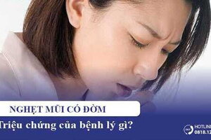 Nghẹt mũi có đờm là triệu chứng bệnh gì? Lý do, cách điều trị