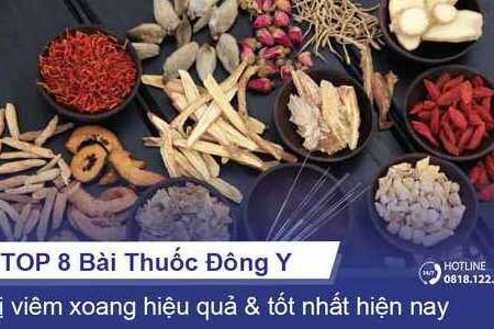 TOP 8 bài thuốc Đông Y trị viêm xoang tốt hiện nay