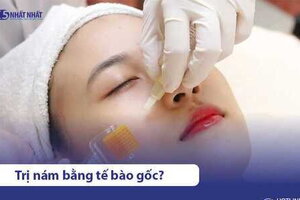 Tế bào gốc trị nám có hiệu quả không? Phương pháp nào tốt?