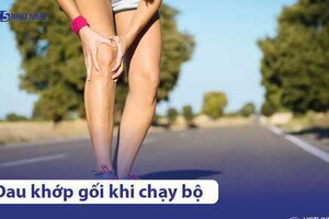 Đau đầu gối khi chạy bộ: Nguyên nhân, điều trị & cách phòng tránh