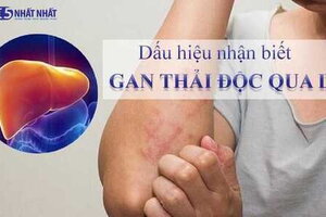 Dấu hiệu nhận biết gan thải độc qua da