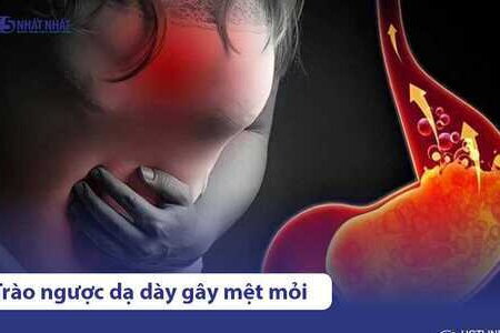 Trào ngược dạ dày gây mệt mỏi: Nguyên nhân & cách khắc phục