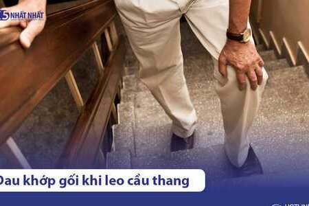 Đau đầu gối khi leo cầu thang là bệnh gì? Điều trị thế nào?