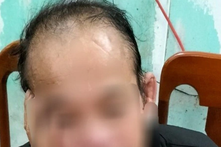Bắt giữ nghi phạm hiếp dâm cụ bà 85 tuổi ở Quảng Trị