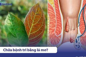 5 Cách dùng lá mơ chữa bệnh trĩ đúng cách, hiệu quả tại nhà