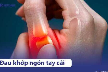 Đau khớp ngón tay cái là bệnh gì? Phải làm sao để điều trị?