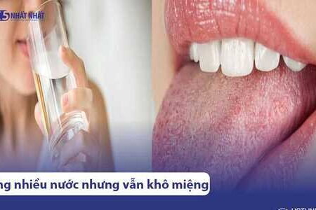 Uống nhiều nước nhưng vẫn khô miệng: Dấu hiệu bệnh nguy hiểm