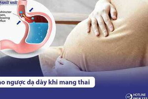 Cách trị trào ngược dạ dày thực quản khi mang thai cho bà bầu 