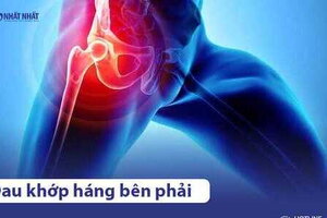 Đau khớp háng bên phải là bệnh gì? Điều trị như thế nào?