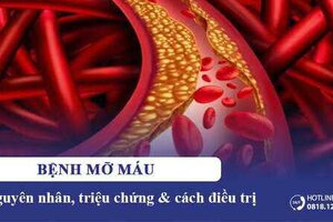 Bệnh mỡ máu: Nguyên nhân, triệu chứng & cách điều trị