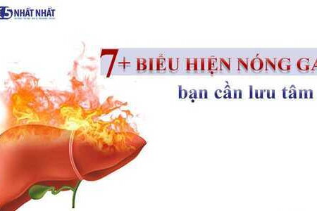 7+ biểu hiện nóng gan bạn cần lưu tâm