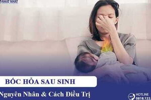 Hiện tượng bốc hỏa sau sinh: Nguyên nhân & cách điều trị