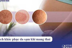 Cách khắc phục da sạm khi mang thai