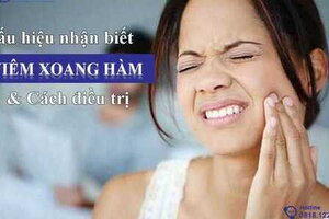 Cách nhận biết triệu chứng viêm xoang hàm