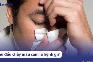 Đau đầu, chảy máu cam là triệu chứng bệnh gì? Có nguy hiểm không?