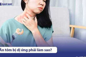 Ăn tôm bị dị ứng nổi mề đay: Mẹo chữa tại nhà hiệu quả, an toàn
