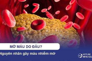 Mỡ máu do đâu? Nguyên nhân gây máu nhiễm mỡ