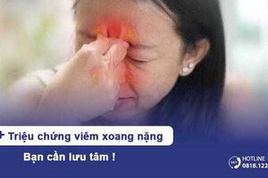 7+ triệu chứng viêm xoang nặng bạn cần lưu tâm