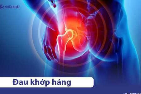 Đau khớp háng: Nguyên nhân, triệu chứng & cách khắc phục