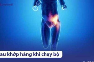 Đau khớp háng khi chạy bộ: Nguyên nhân & cách khắc phục