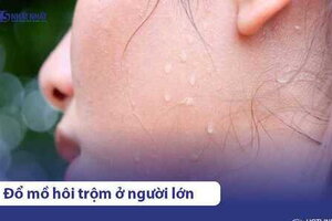 Đổ mồ hôi trộm ban đêm ở người lớn: 9 Nguyên nhân nên biết